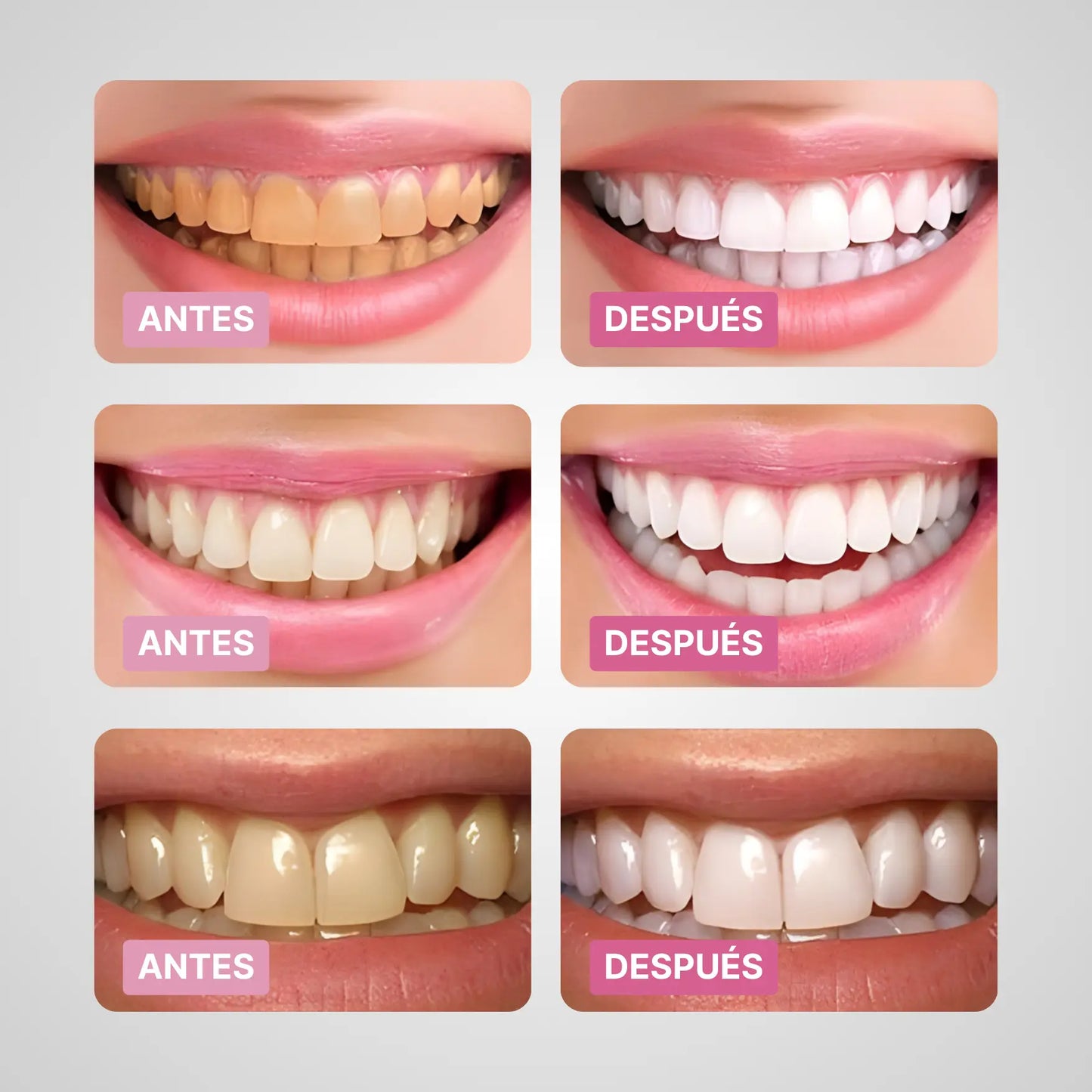 Bright White™ – Gel Blanqueador Dental Profesional